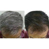 New! 25g Polygonum Multiflorum White Hair Black Stop Hair Loss Serum Nutrition Care Powder Growth Products